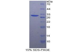 SDS-PAGE analysis of Human Connexin 37 Protein. (GJA4 Protein)