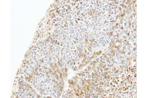 IHC-P Image Immunohistochemical analysis of paraffin-embedded 59T xenograft, using CapZ beta, antibody at 1:100 dilution. (CAPZB antibody  (Center))