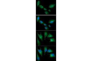 ICC/IF analysis of HMOX in A549 cells line, stained with DAPI (Blue) for nucleus staining and monoclonal anti-human HMOX antibody (1:100) with goat anti-mouse IgG-Alexa fluor 488 conjugate (Green) ICC/IF analysis of HMOX in HeLa cells line, stained with DAPI (Blue) for nucleus staining and monoclonal anti-human HMOX antibody (1:100) with goat anti-mouse IgG-Alexa fluor 488 conjugate (Green) (HMOX1 antibody  (AA 1-266))
