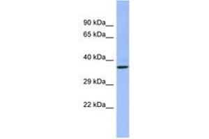 Image no. 1 for anti-CHRNA7 (Cholinergic Receptor, Nicotinic, alpha 7, Exons 5-10) and FAM7A (Family with Sequence Similarity 7A, Exons A-E) Fusion (CHRFAM7A) (AA 107-156) antibody (ABIN6742700) (CHRFAM7A antibody  (AA 107-156))