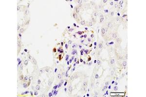 Formalin-fixed and paraffin embedded mouse kidney tissue labeled Anti-Mouse IgA Polyclonal Antibody, Unconjugated  at 1:200, followed by conjugation to the secondary antibody and DAB staining (Rabbit anti-Mouse IgA Antibody)