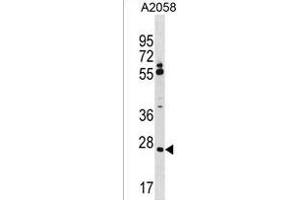 CNPY3 Antibody (N-term) (ABIN1539523 and ABIN2850084) western blot analysis in  cell line lysates (35 μg/lane). (TNRC5 antibody  (N-Term))