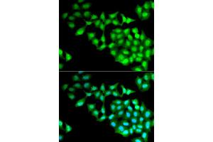 Immunofluorescence analysis of MCF-7 cell using RNGTT antibody.