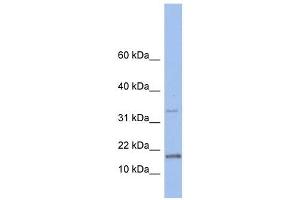 TCL1A antibody used at 1 ug/ml to detect target protein. (TCL1A antibody  (N-Term))