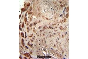 Immunohistochemistry (IHC) image for anti-Protein Kinase, Interferon-Inducible Double Stranded RNA Dependent Activator (PRKRA) antibody (ABIN3003466) (PRKRA antibody)