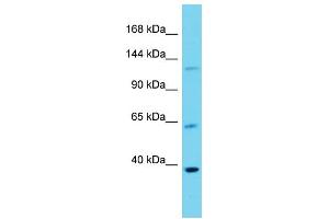 Host: Rabbit  Target Name: Dlg3  Sample Tissue: Mouse Lung lysates  Antibody Dilution: 1. (DLG3 antibody  (Middle Region))