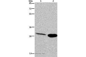 Western blot analysis of Human hepatocellular carcinoma and mouse skeletal muscle tissue, using CA3 Polyclonal Antibody at dilution of 1:200