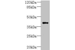 Western blot All lanes: PSTPIP2 antibody at 6 μg/mL + Raji whole cell lysate Secondary Goat polyclonal to rabbit IgG at 1/10000 dilution Predicted band size: 39, 37 kDa Observed band size: 39 kDa