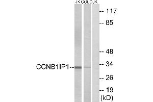 Western blot analysis of extracts from Jurkat cells and COLO cells, using CCNB1IP1 antibody. (CCNB1IP1 antibody)