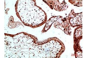 Immunohistochemical analysis of paraffin-embedded human-placenta, antibody was diluted at 1:200 (Ubiquitin B antibody)