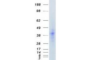Validation with Western Blot