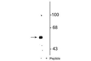 GABRB3 antibody  (pSer408, pSer409)