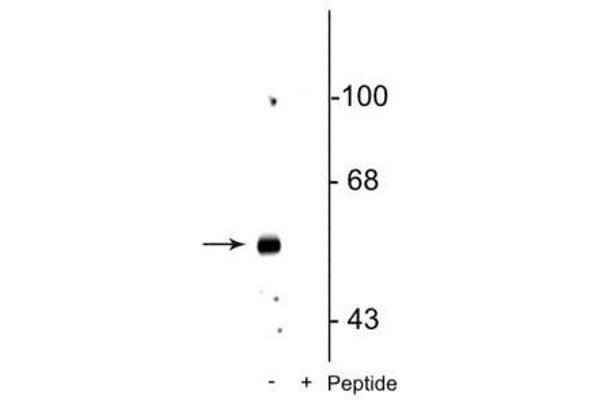 GABRB3 antibody  (pSer408, pSer409)