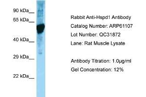 Western Blotting (WB) image for anti-Heat Shock 60kDa Protein 1 (Chaperonin) (HSPD1) (C-Term) antibody (ABIN970918) (HSPD1 antibody  (C-Term))