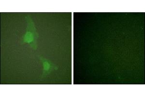Immunofluorescence analysis of HeLa cells, using ADD1 (Ab-726) antibody. (alpha Adducin antibody)