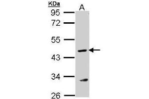 WB Image Sample (30 ug of whole cell lysate) A: MOLT4 , 10% SDS PAGE antibody diluted at 1:1000 (ASL antibody)