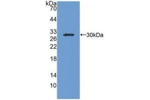 Detection of Recombinant IGFBP1, Human using Polyclonal Antibody to Insulin Like Growth Factor Binding Protein 1 (IGFBP1) (IGFBPI antibody  (AA 36-235))