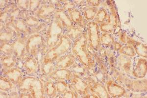 Anti-CXCR3 Picoband antibody, IHC(P): Rat Kidney Tissue
