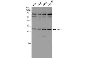 WB Image RPS3 antibody detects RPS3 protein by western blot analysis.