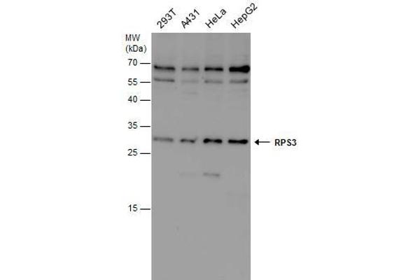 RPS3 anticorps