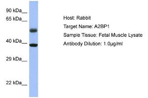 WB Suggested Anti-A2BP1 Antibody Titration: 0. (A2BP1 antibody  (N-Term))