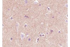 ABIN6268720 at 1/100 staining human brain tissue sections by IHC-P. (Nerve Growth Factor antibody  (Internal Region))
