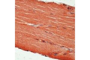 Formalin-fixed, paraffin-embedded human skeletal muscle stained with c-erbB3 Ab using peroxidase-conjugate and AEC chromogen. (ERBB3 antibody)