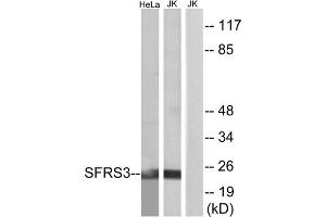 Western blot analysis of extracts from HeLa cells and Jurkat cells, using SFRS3 antibody. (SRSF3 antibody  (C-Term))