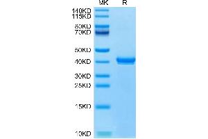 S100B Protein (AA 2-92) (Fc Tag)