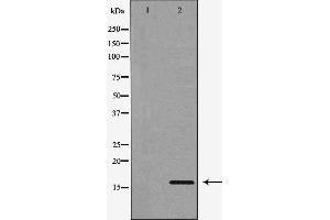 Western blot analysis of extracts of NCI-H460, using CST3 antibody.