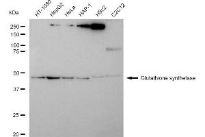 anti-Glutathione Synthetase (GSS) antibody