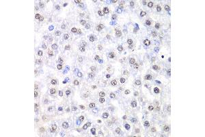 Immunohistochemistry of paraffin-embedded rat liver using NONO antibody at dilution of 1:100 (x40 lens). (NONO antibody)