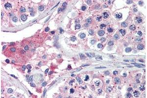 Human Testis: Formalin-Fixed, Paraffin-Embedded (FFPE) (BACE2 antibody  (AA 44-59))
