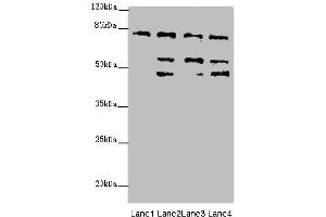 Western blot analysis of (1) HeLa whole cell lysates, (2) 293T whole cell lysates, (3) Mouse liver tissue, and (4) Mouse kidney tissue, using ZFYVE1 antibody (6.