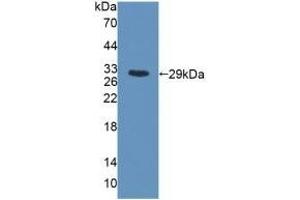 Detection of Recombinant MYH6, Rat using Polyclonal Antibody to Myosin Heavy Chain 6, Cardiac Muscle, Alpha (MYH6) (MYH6 antibody  (AA 419-666))