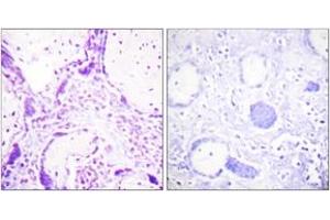 Immunohistochemistry (IHC) image for anti-Peroxisome Proliferator-Activated Receptor gamma (PPARG) (AA 78-127) antibody (ABIN1532398)