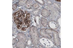 Immunohistochemical staining (Formalin-fixed paraffin-embedded sections) of human kidney with LAMA5 monoclonal antibody, clone CL3118  shows strong immunoreactivity in basement membrane of renal tubules and membranous positivity in glomeruli.