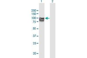 Western Blot analysis of OPA1 expression in transfected 293T cell line by OPA1 monoclonal antibody (M02), clone 8A20. (OPA1 antibody  (AA 851-960))