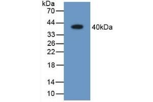 Detection of Recombinant ARL1, Human using Polyclonal Antibody to Aldose Reductase Like Protein 1 (ARL1) (ARL1 antibody  (AA 1-316))