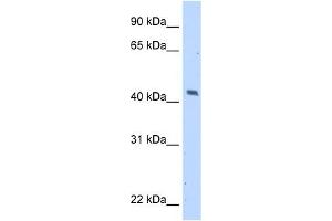 MAGEA1 antibody used at 5 ug/ml to detect target protein.