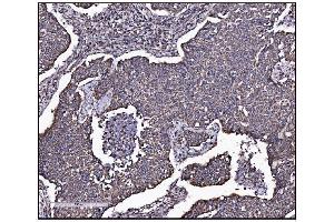 IHC analysis of FABP-1/GOT2 using anti-FABP-1/GOT2 antibody (ABIN7601426). (GOT2 antibody  (AA 35-430))