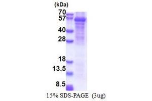 SDS-PAGE (SDS) image for Fatty Acid Amide Hydrolase 2 (FAAH2) (AA 32-532) protein (His tag) (ABIN5853415) (FAAH2 Protein (AA 32-532) (His tag))