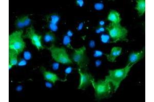 Anti-DOK7 mouse monoclonal antibody (ABIN2455827) immunofluorescent staining of COS7 cells transiently transfected by pCMV6-ENTRY DOK7 (RC219267). (DOK7 antibody)