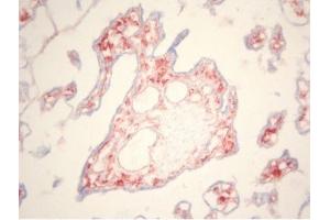 Frozen human placenta, stained with ABIN111878 (CD163 antibody)