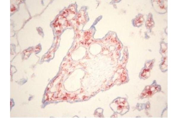CD163 antibody