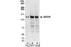 Western Blotting (WB) image for anti-Lysine (K)-Specific Demethylase 4B (KDM4B) (AA 1056-1096) antibody (ABIN7451825) (KDM4B antibody  (AA 1056-1096))