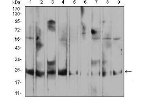 Western Blotting (WB) image for anti-Ras-related Protein Ral-A (rala) (AA 71-203) antibody (ABIN5876697) (rala antibody  (AA 71-203))