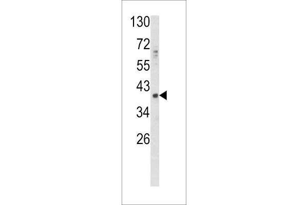 GDF1 antibody  (N-Term)