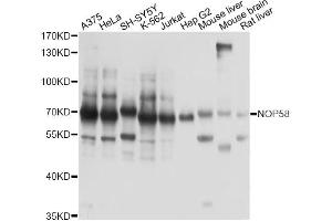 Western blot analysis of extracts of various cell lines, using NOP58 antibody. (NOP58 antibody)
