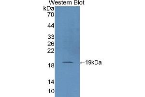 Detection of Recombinant SOD1, Pig using Polyclonal Antibody to Superoxide Dismutase 1 (SOD1) (SOD1 antibody  (AA 2-153))